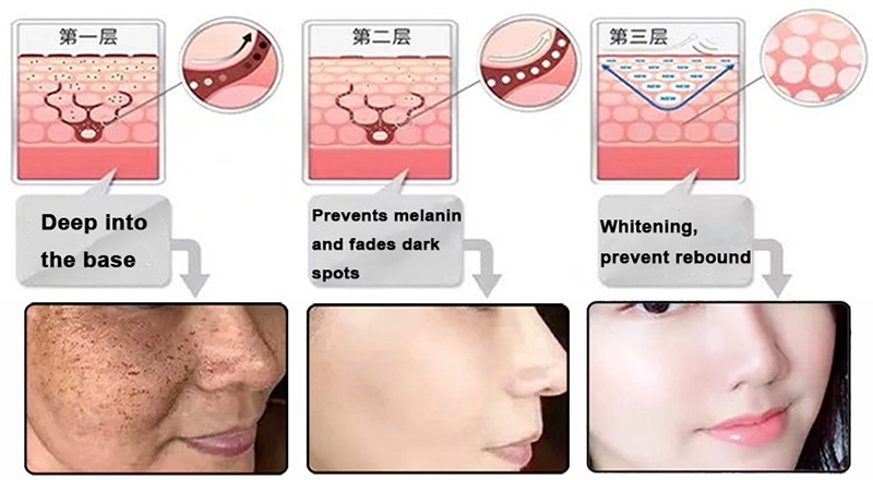 sepiwhite msh powder Whitening